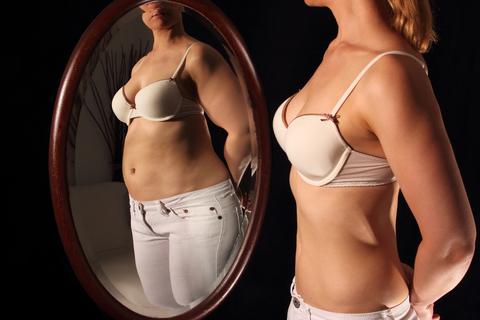 Von Magersucht Betroffene haben oft eine Körperschemastörung, die ihren Blick verzerrt: Obwohl sie sehr schlank sind, nehmen sie sich im Spiegel als dick wahr