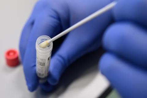 04.03.2020, Baden-Württemberg, Stuttgart: Ein Mann zeigt kurz bevor die Corona-Ambulanz des Klinikums Stuttgart im Katharinenhospital öffnet einen Abstrich für das Testverfahren auf das Virus SARS-CoV-2. In der Corona-Ambulanz können sich Patienten testen lassen. Foto: Sebastian Gollnow/dpa +++ dpa-Bildfunk +++