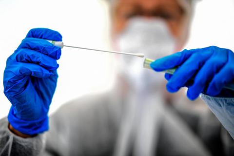 Positiv oder nicht? Per Abstrichstäbchen wird auf eine Corona-Infektion getestet. In Mengerskirchen häufen sich im März die Fälle: 33 Menschen sind damals infiziert und der Marktflecken ist plötzlich ein Hotspot im Landkreis Limburg-Weilburg.  Symbolfoto: Britta Pedersen/dpa 