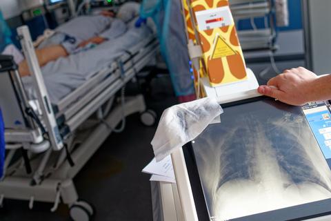 Das Bild einer Lunge ist in der Intensivstation des Luisenhospitals auf dem Bildschirm eines Transportablen Röntgengerät zu sehen. In der Station werden zur Zeit acht Patienten mit Covid-19 behandelt.  Symbolbild: dpa