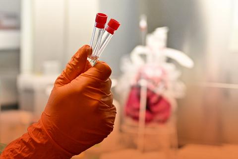 Im einem Labor werden Laboruntersuchungen zur Abklärung des Coronavirus vorgenommen.  Foto: dpa