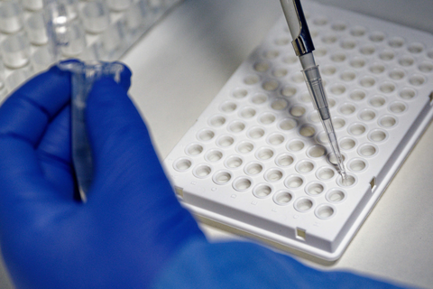 Eine Labor-Mitarbeiterin füllt mit einer Pipette zur Vorbereitung von Corona PCR Tests eine Testflüssigkeit in eine Trägerplatte.  Foto: Henning Kaiser/dpa